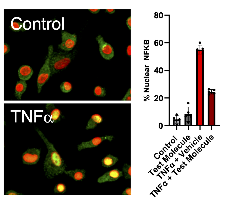 NFkB translocation 