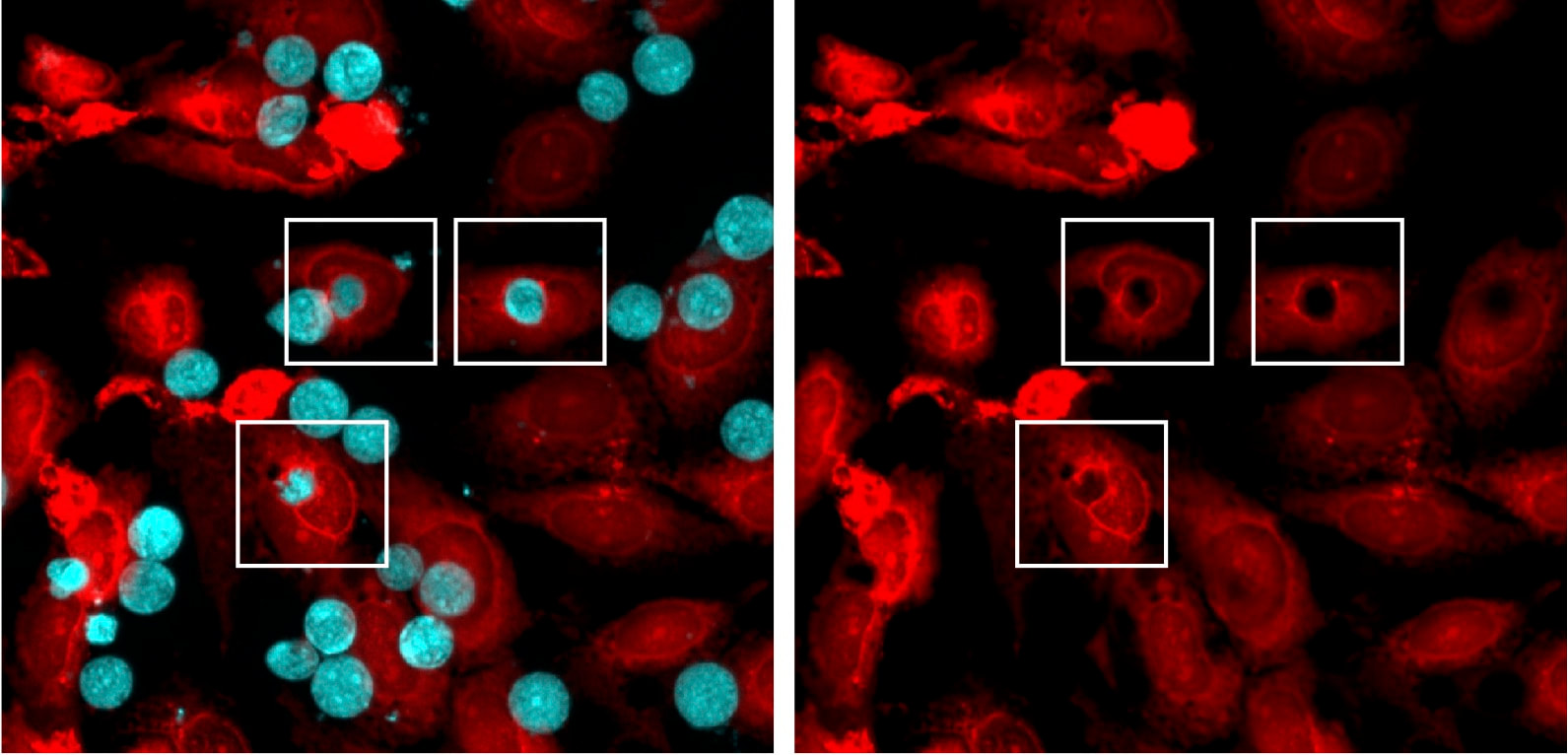 Phagocytosis