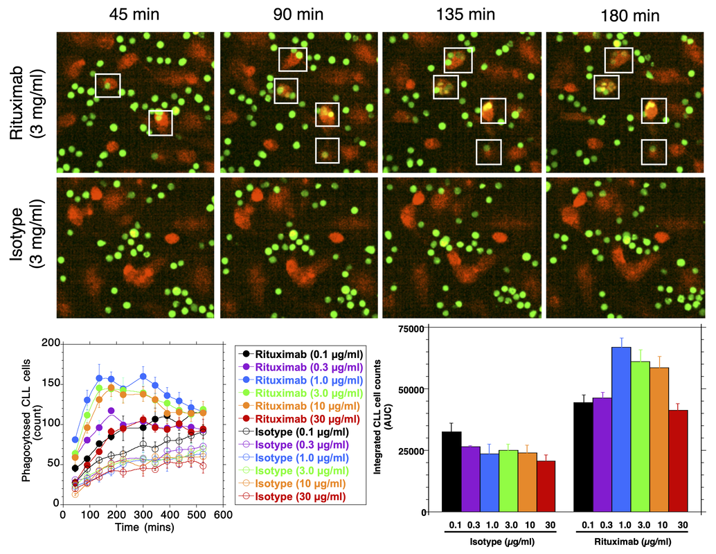 Antibody-dependent enhancement of tumour cell phagocytosis